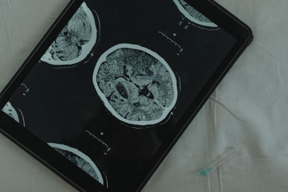 A brain scan displayed on a tablet, representing neurology conference topics.